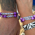Defeat ALS - ALS Association Support & Research